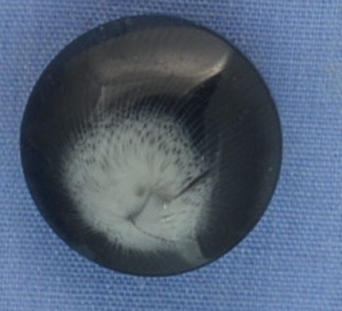 17mm Grey Shank Button (per button)