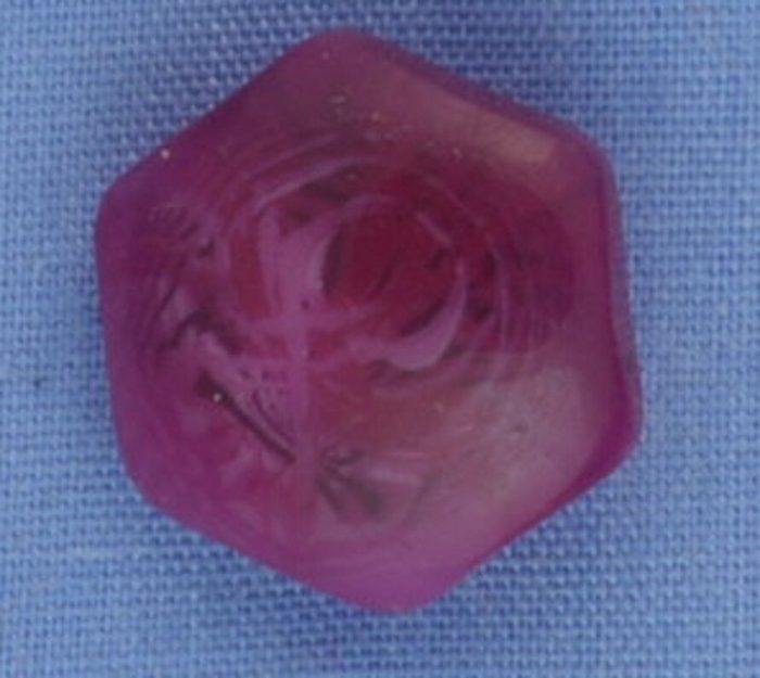13mm Hot Pink Shank Button (per button)