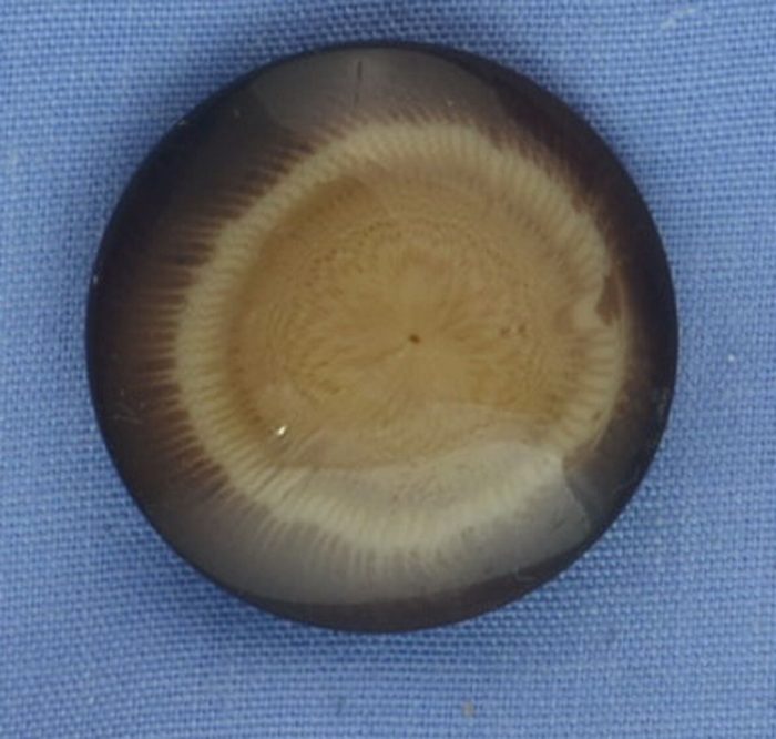 22mm Brown Low Shank Button (per button)