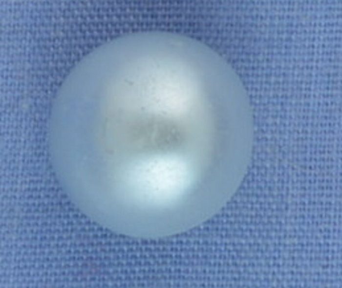 10mm Blue Domed Shank Button (x 2 buttons)