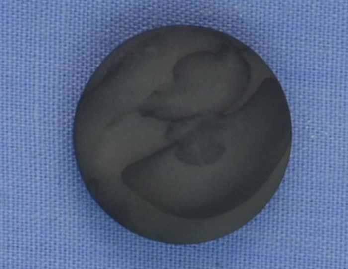 16mm Green / Grey Shank Button (x 2 buttons)